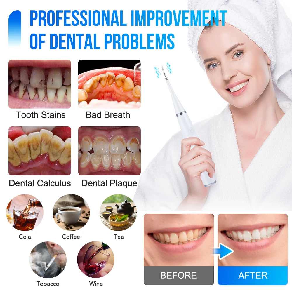 Dental whitening kit